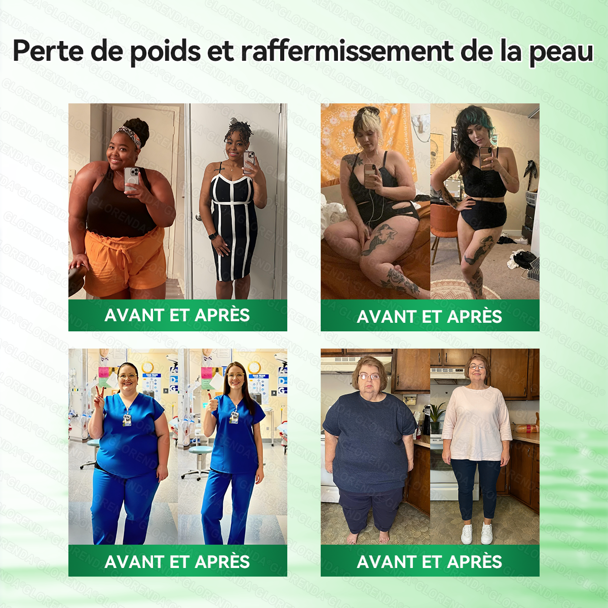 Boutique officielle 🍂🍂𝐆𝐋𝐎𝐑𝐄𝐍𝐃𝐀® Moringa · Berbérine + NAD+ – Patch Microneedle Nano Avancé 10-en-1 (1×/jour, résultats visibles en 7 jours) | Obésité, relâchement cutané, apnée du sommeil, articulations, etc.-LYJ